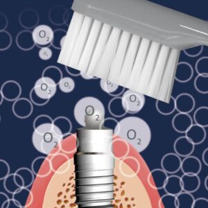 Implaclean hambapasta implantaatide hoolduseks