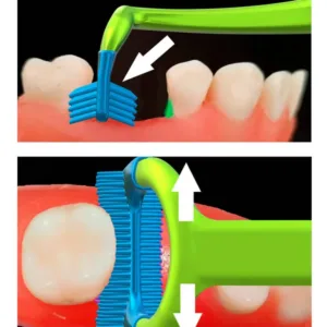how-it-works-ergoprox-1